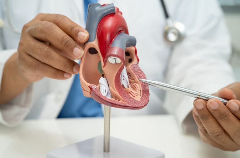 Obstructive vs. Nonobstructive Hypertrophic Cardiomyopathy: Understanding Your Diagnosis